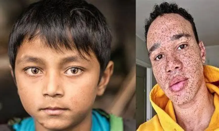 Struktur genetika wajah manusia yang menciptakan kemiripan